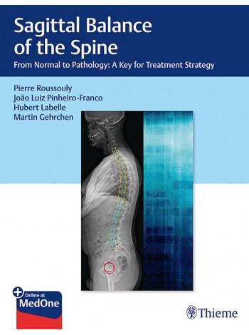 Sagittal Balance of the Spine